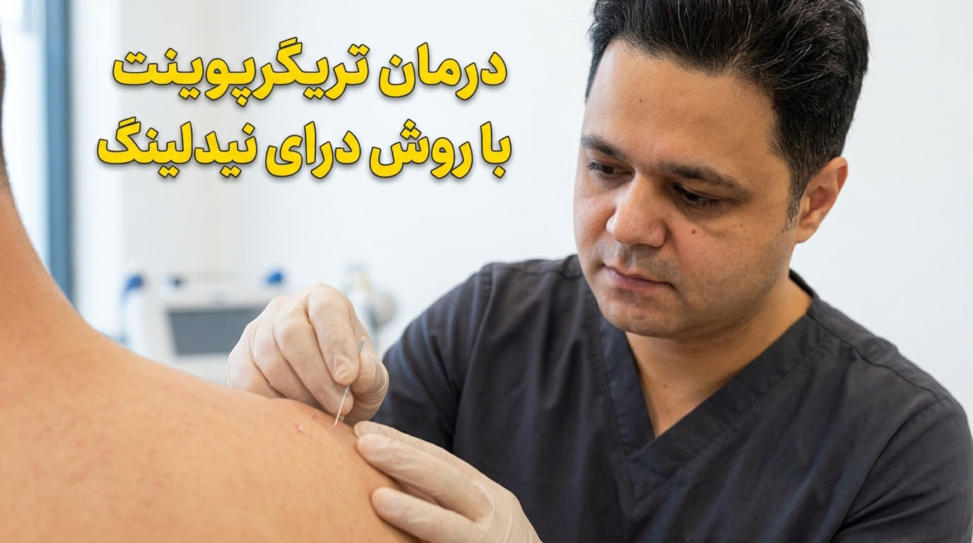 اجرای درای نیدلینگ توسط فیزیوتراپیست آموزش‌دیده