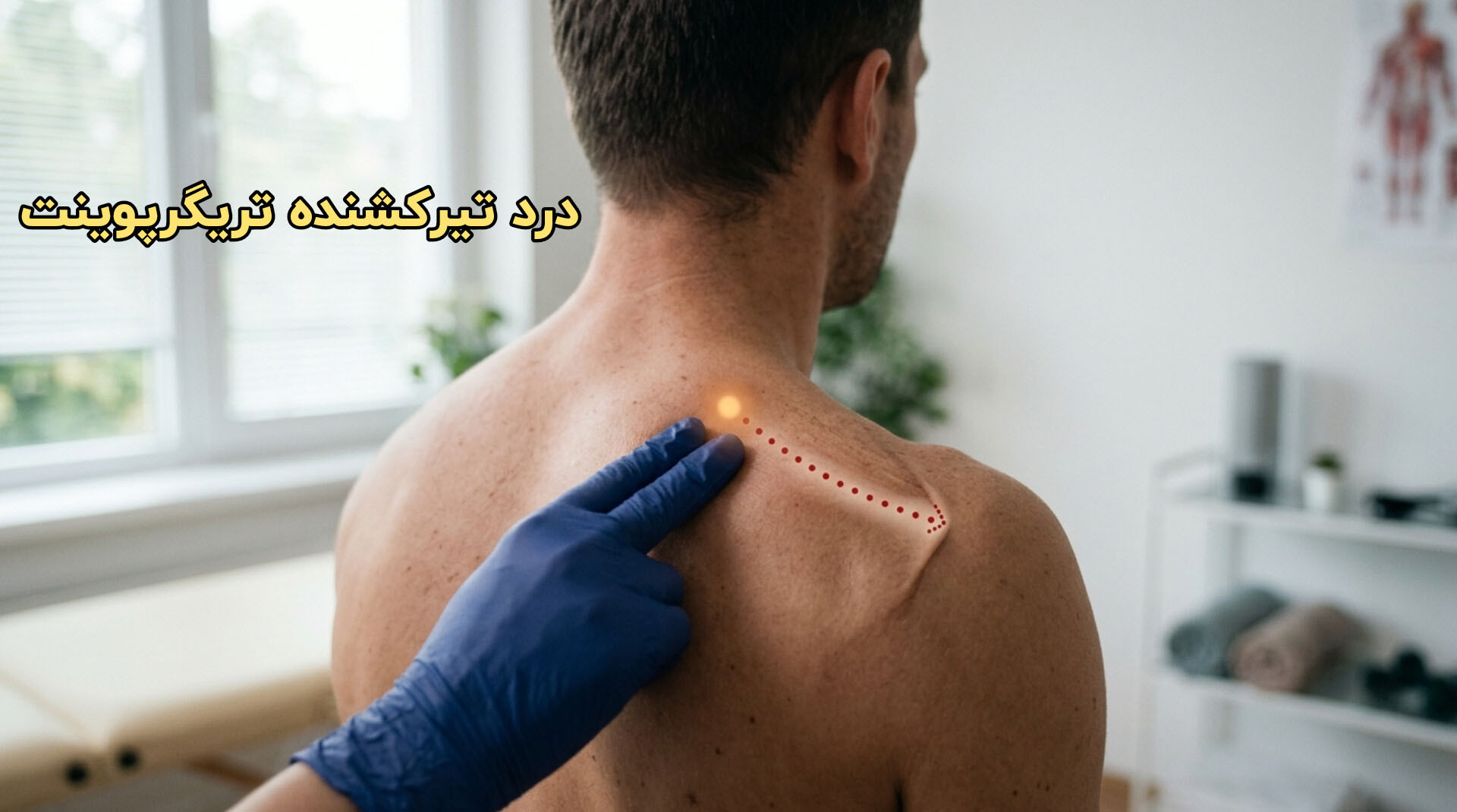 معاینه بالینی عضله توسط فیزیوتراپیست و لمس نقطه ماشه‌ای حساس جهت بازتولید درد موضعی و ارجاعی بیمار.