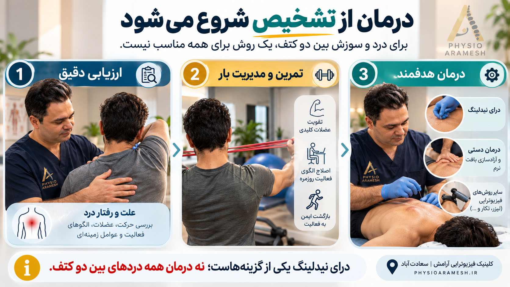 درمان درد سوزشی بین دو کتف با فیزیوتراپی، تمرین و در صورت نیاز درای نیدلینگ