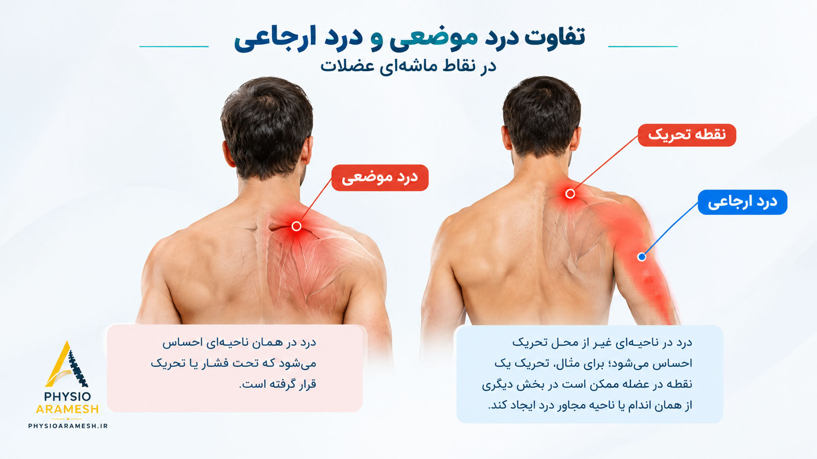 تفاوت درد موضعی و درد ارجاعی در نقاط ماشه‌ای عضلات