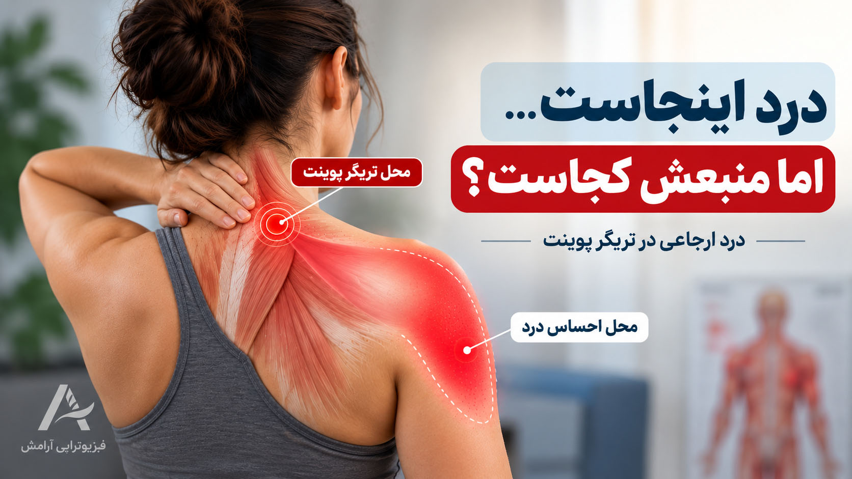درد ارجاعی تریگر پوینت؛ تفاوت محل نقطه ماشه‌ای با محل احساس درد
