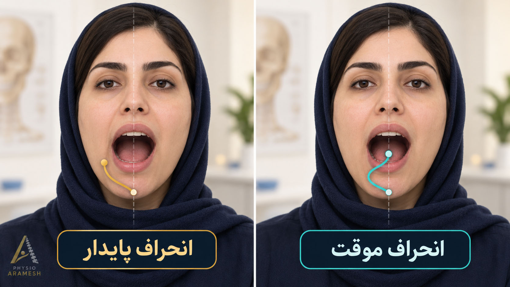 تفاوت انحراف موقت و انحراف پایدار فک