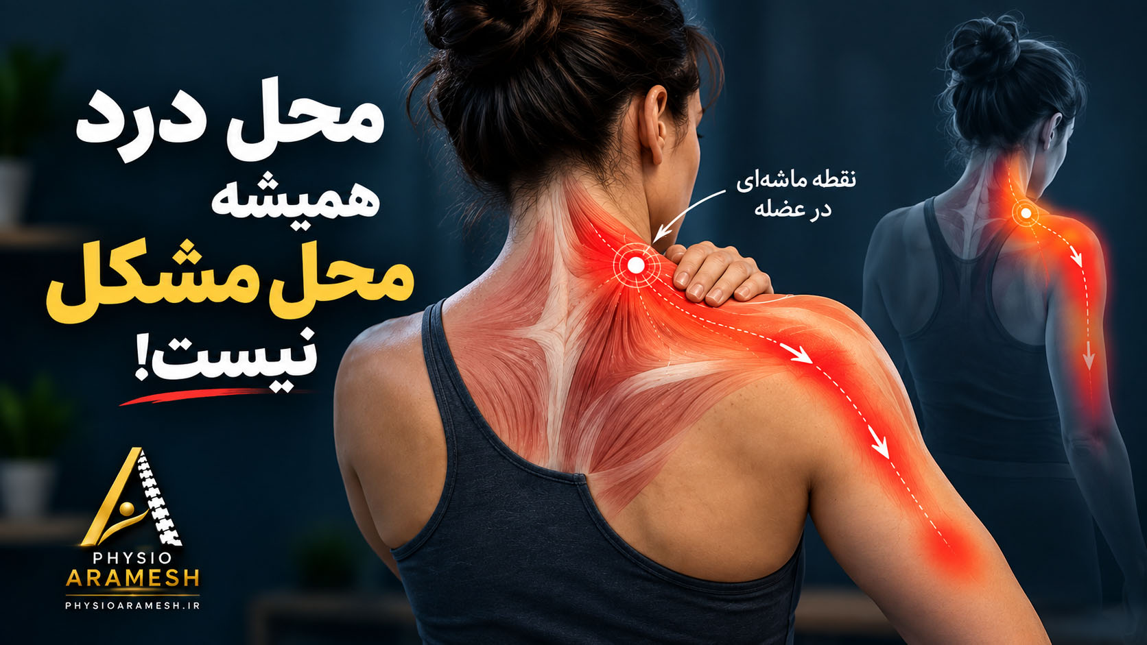 درد ارجاعی تریگر پوینت؛ تفاوت محل نقطه ماشهای با محل احساس درد
